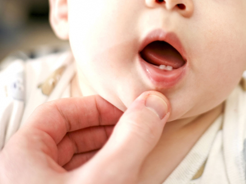 Tout sur la poussée dentaire de votre bébé